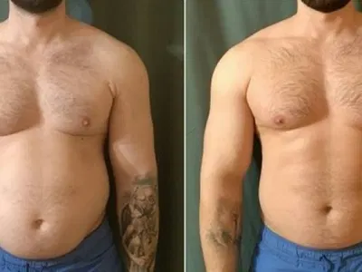 David K. verified Gelatine Sculpt user — natural Ozempic alternative results